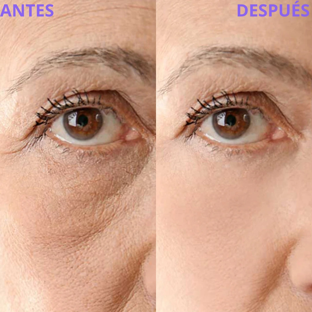 Lemora Masajeador Facial + Serum de Regalo