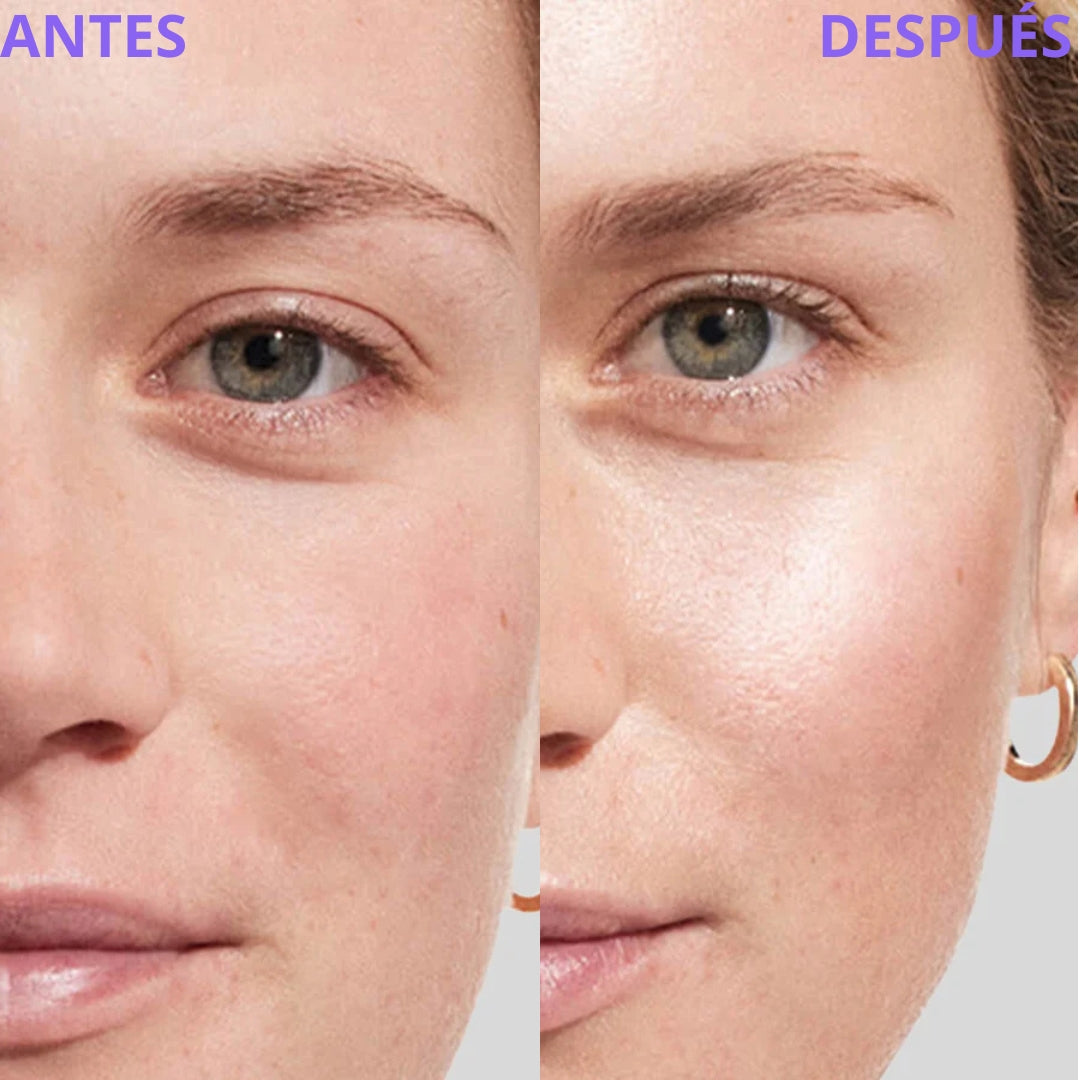 Lemora Masajeador Facial + Serum de Regalo