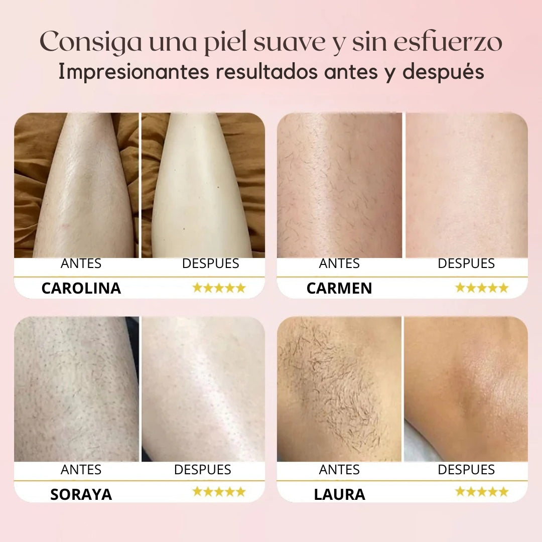 Depiladora Portátil con Doble Cabezal Virelle